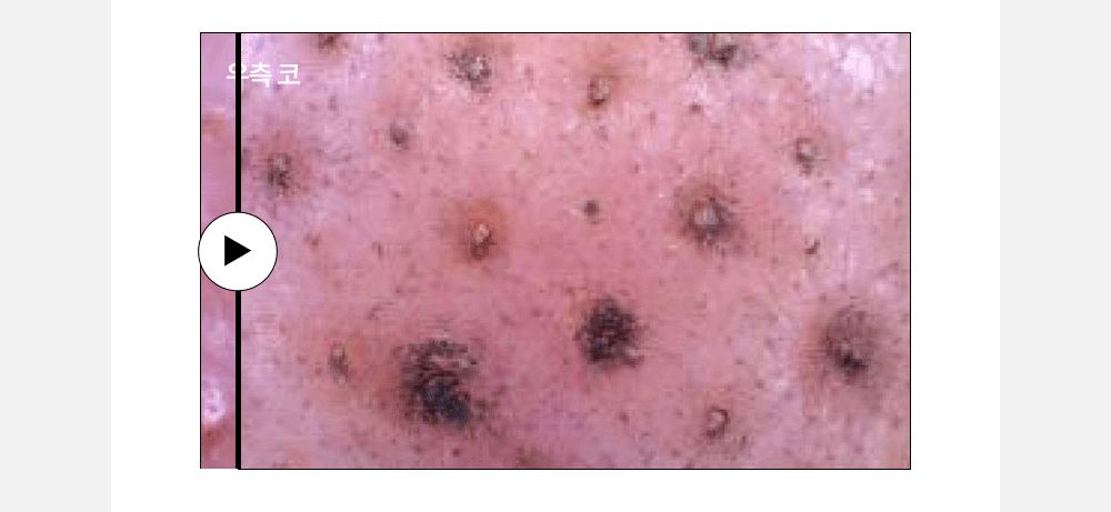 Dermarrsance Highprime Bubble-Shot Deeptox Mask 34g x1 piece