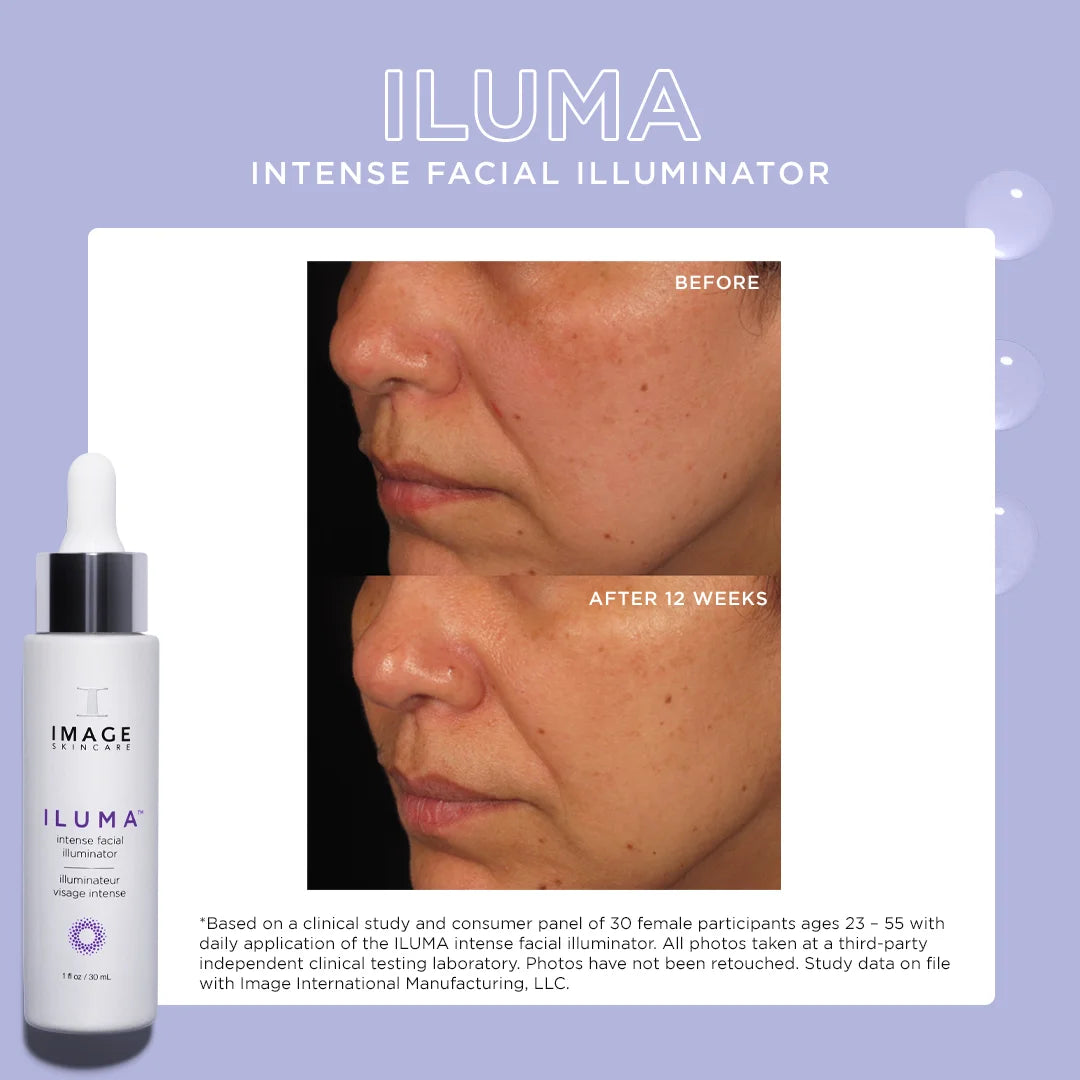 ILUMA intense facial illuminator
