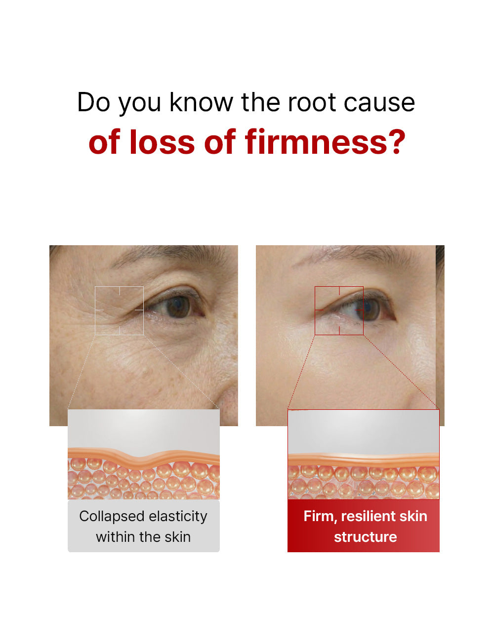 Dermarssance collagen silk peptide lifting ampule