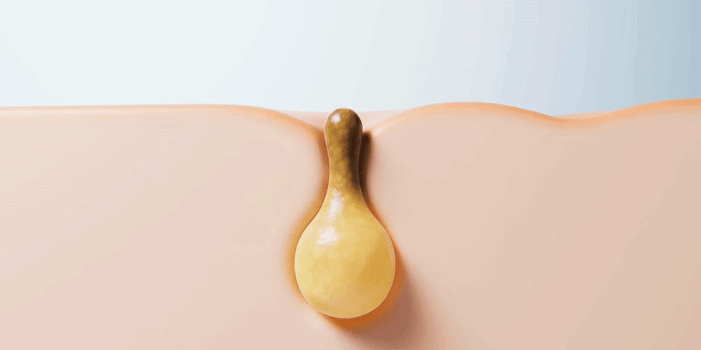 Collagen Deep Clean Capsule Cleanser