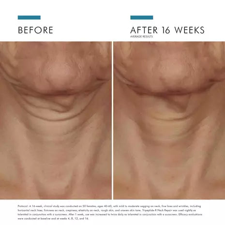 Skinceuticals Tripeptide-R Neck Repair&nbsp;