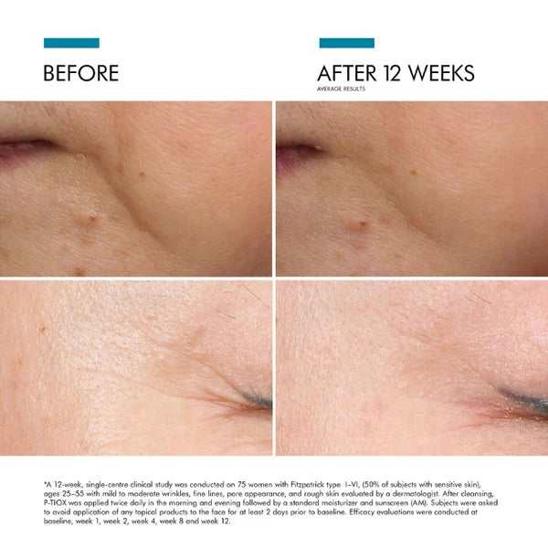 SkinCeuticals P-TIOX Anti – Wrinkle Cream