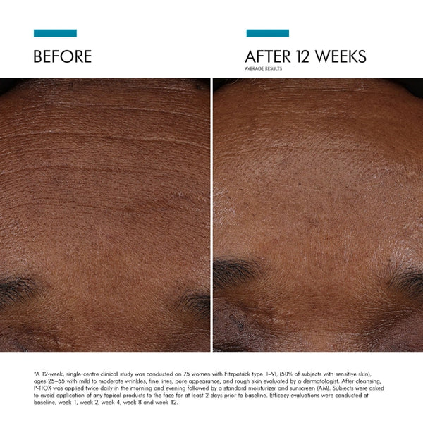 SkinCeuticals P-TIOX Anti – Wrinkle Cream